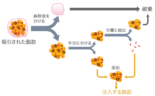 脂肪幹細胞注入のイメージ